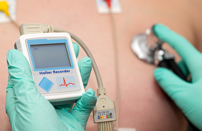 Tansiyon ve Ritim Holter